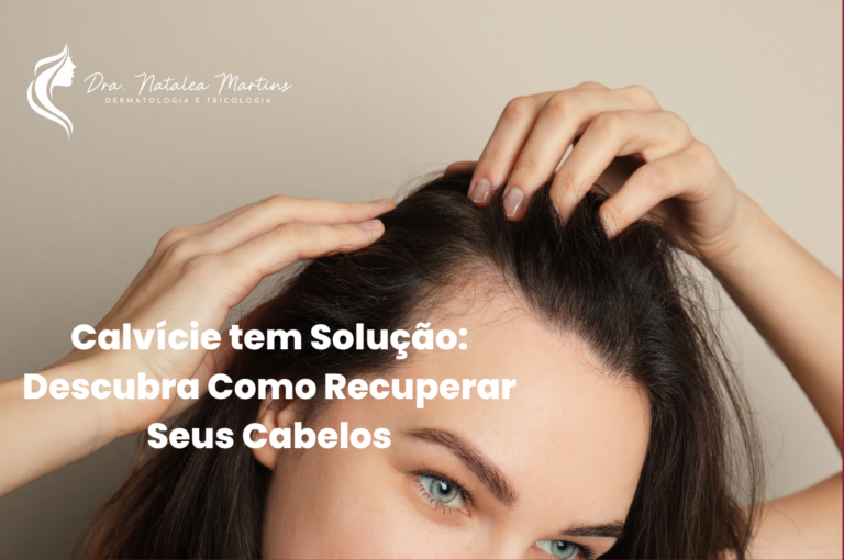 Calvície tem Solução: Descubra Como Recuperar Seus Cabelos