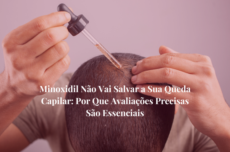 Minoxidil Não Vai Salvar a Sua Queda Capilar: Por Que Avaliações Precisas São Essenciais